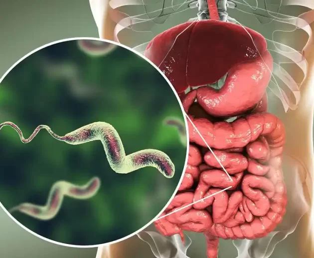 acute diarrhoea disease