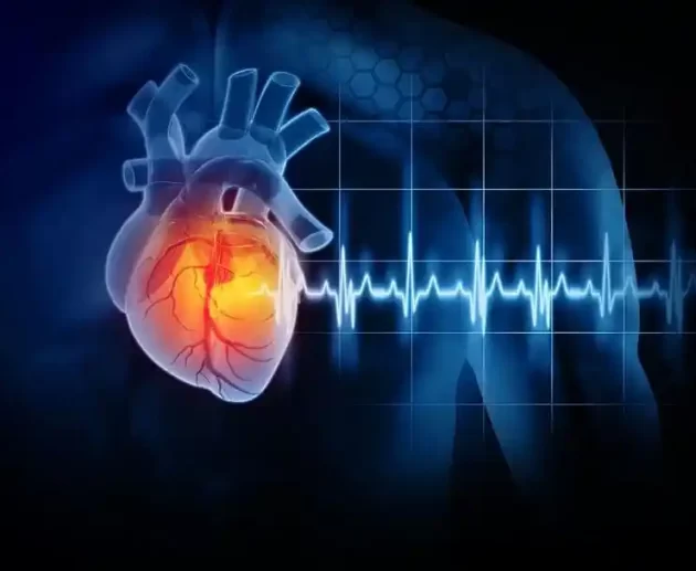 Acute Coronary Syndromes