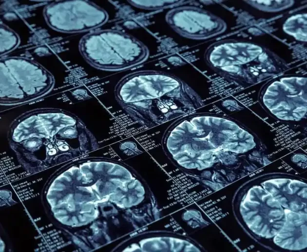 alcohol's impact on the brain