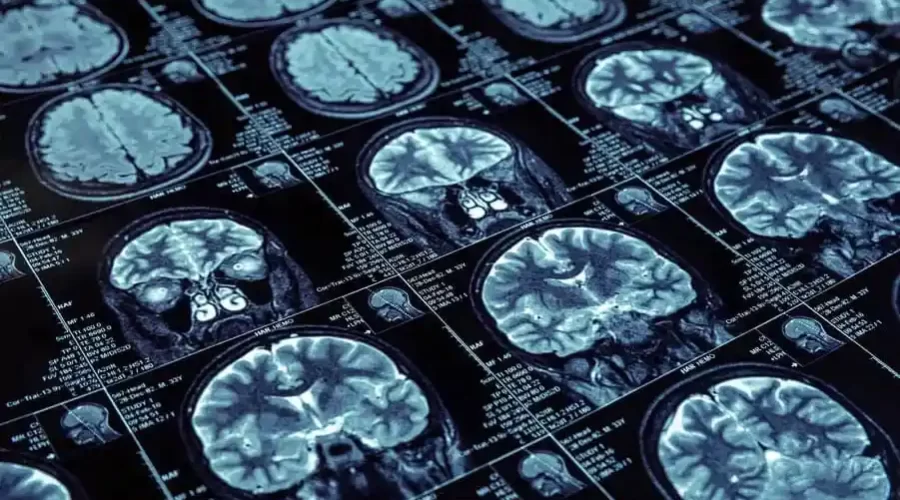 alcohol's impact on the brain