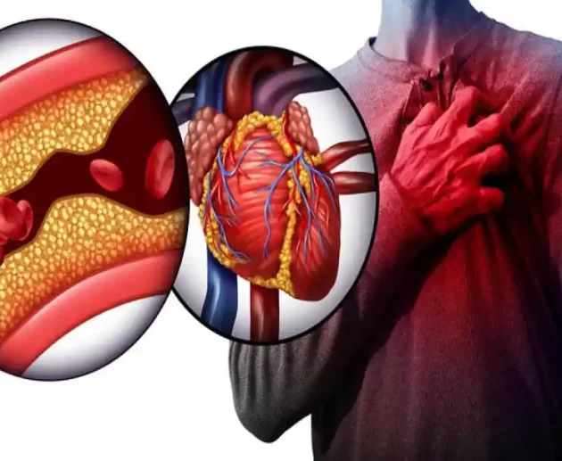 sign of a heart attack