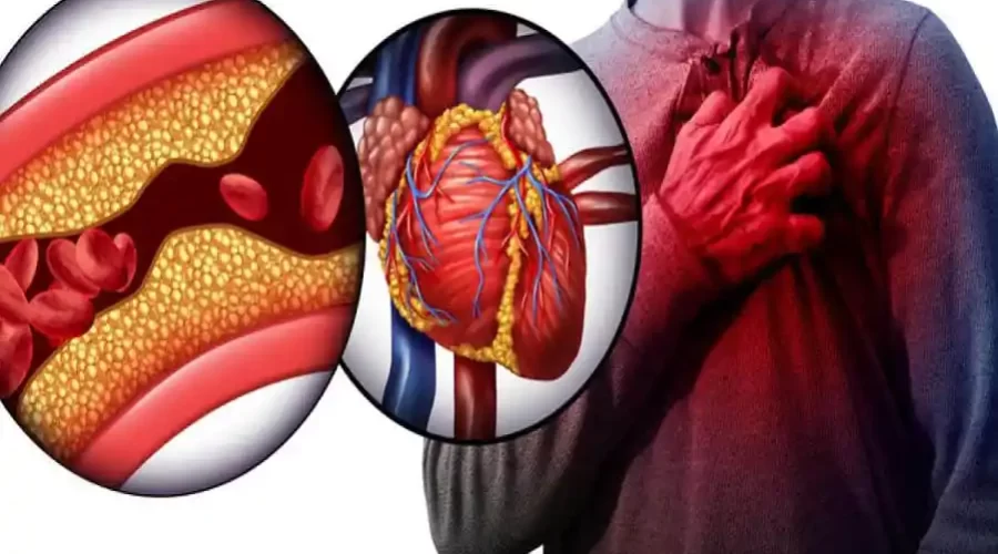 sign of a heart attack