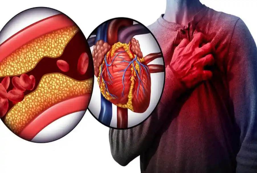 sign of a heart attack